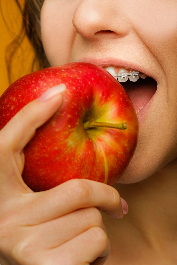 Foods To Avoid After Getting Braces