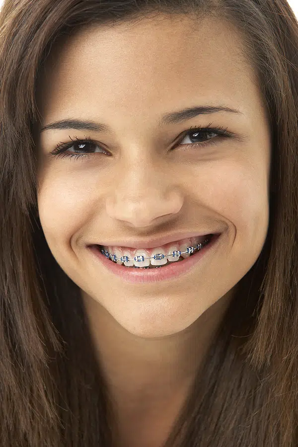 Affordable Orthodontics In Smithtown NY