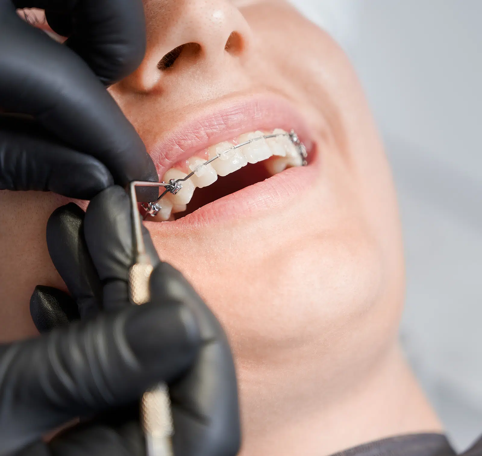 Dentists Vs. Orthodontists
